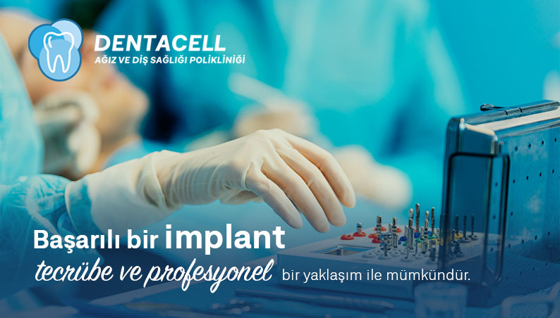 Implant (racine de dent artificielle)
