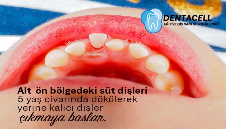 Sut Dislerinin Ve Kalici Dislerin Surme Zamanlari Dentacell Agiz Ve Dis Sagligi Poliklinigi