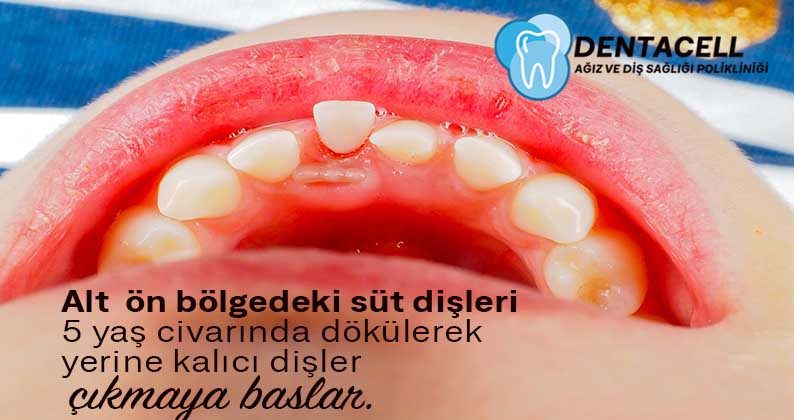 Süt Dişlerinin Ve Kalıcı Dişlerin Sürme Zamanları